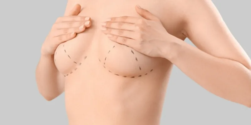 Breast aesthetics surgery consultation with specialist surgeon in Antalya Turkey