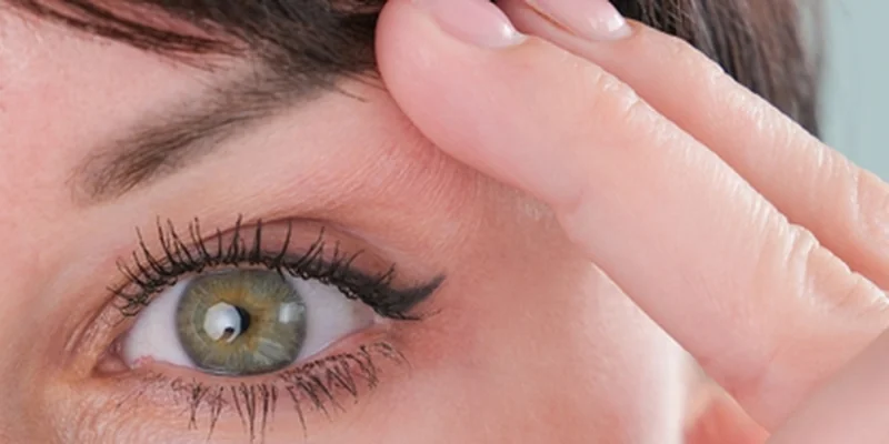 Beautiful open eyes after eyelid blepharoplasty surgery in Antalya Turkey